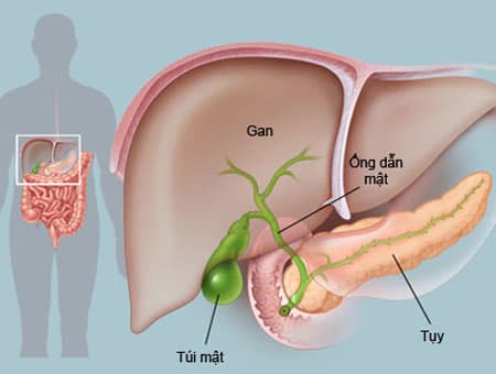 Sỏi mật và những điều cần biết
